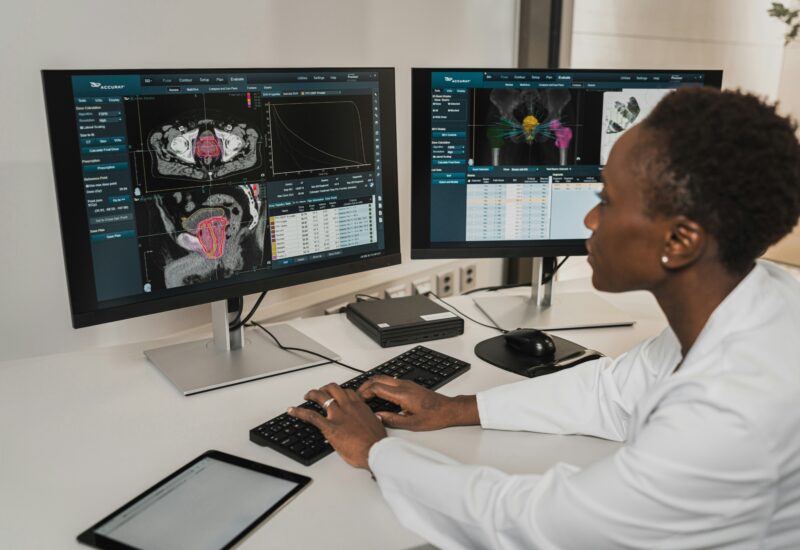Scan CT (Tomodensitométrie)